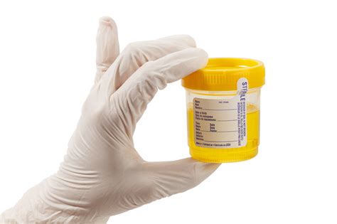 bring in pill bottle for drug test|can you tape urine for drug testing.